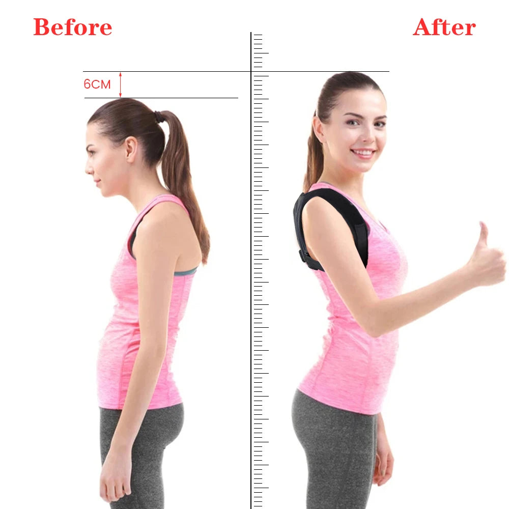 AlignCo Posture Corrector
